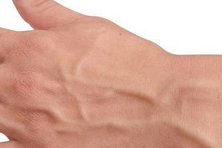 What Causes Hand Veins To Bulge?