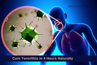 How To Cure Tonsillitis In 4 Hours Naturally