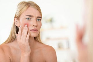 Adulting Is Hard — And So Is Fighting Acne. Here’s What Helps.