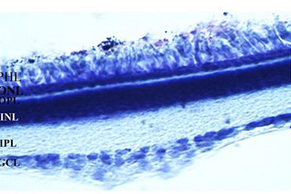 The NRH: Quinone Oxidoreductase Enzyme (QR2) has a Particular Distribution in Avian Retina