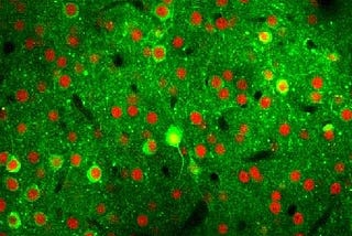 Neuroplastic Compensation: How the Brain Maintains Function Despite Neuronal Loss