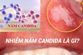 [ Nấm Candida ] Tìm hiểu nguyên nhân gây bệnh và cách chữa trị
