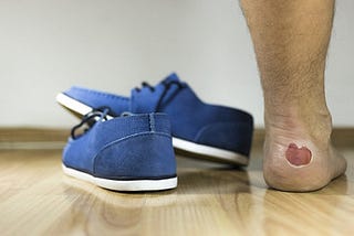 Treating Blisters by Letting Them Heal