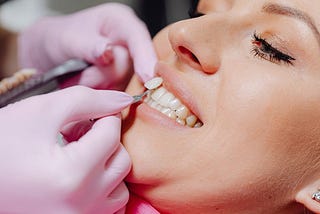 Why Are My Teeth Chipping: Exploring Different Reasons