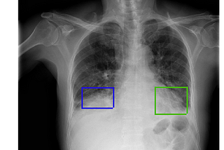 Radiology and Deep Learning