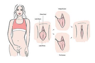 Vaginal Tightening Surgery in Gurgaon | Vaginoplasty — Dr Priya Bansal