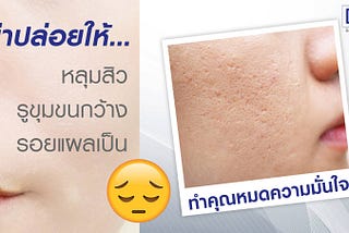 คลินิกรักษาหลุมสิว-BAC Clinic