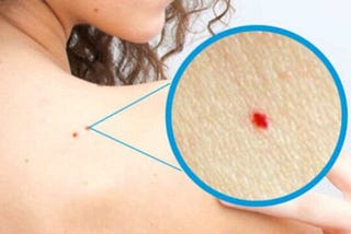 Do you have red dots on skin? Then you should be worried!