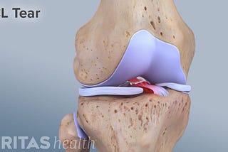 My ACL Journey