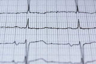 How serious is the situation if my ECG shows BorderLine Abnormality?