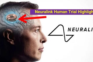 Neuralink Human Trial Highlights