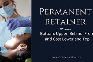 Permanent Bottom Retainer: Upper, Behind, Front and Cost Lower & Top