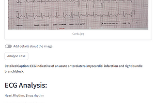 CairoSynth’s groundbreaking application, Cardiologist Assistant