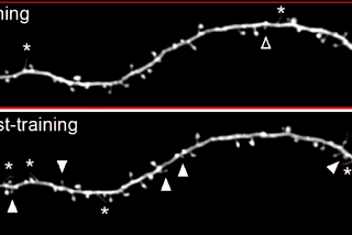 Multiple synapses that are newly formed together after training and sleep on the same dendrite are indicated by the white arrowheads.