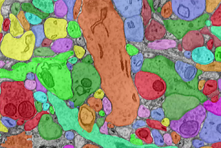 Surface Crack Detection