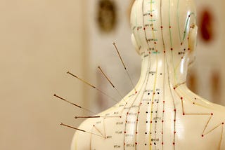 Acupuncture