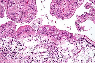 How to get top 1% on Kaggle and help with Histopathologic Cancer Detection