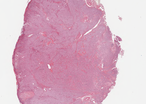 Stain estimation on microscopy whole slide images