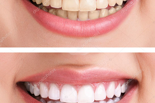 A Million Dollar Smile
5 Tips for Healthy Teeth