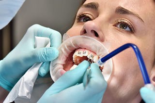 Orthodontic Treatment
