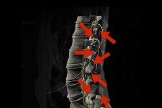 Primary Care Compression