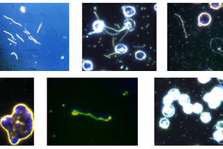 Bacteria segmentation — AI & ML exam