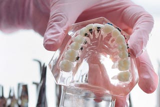 What types of dental braces exist?