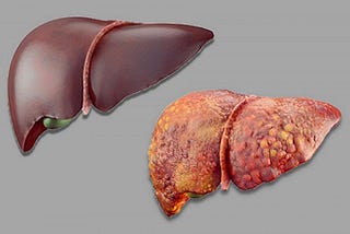 Types of Medicine Diseases of the Liver