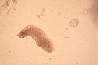 Brain-eating Amoeba Strikes Again: Texas Woman Dies After Using Nasal Irrigation Device