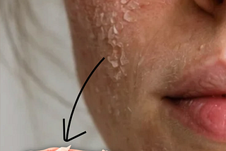 Your Glass Skin Routine Might Be Damaging Your Barrier