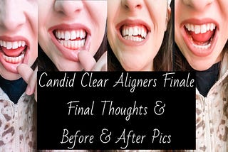 CANDID CLEAR ALIGNERS FINALE // Final Thoughts & Before and After Pics