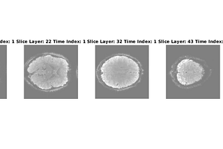 Brain-Computer Imaging & Interfaces: fMRI in Matlab