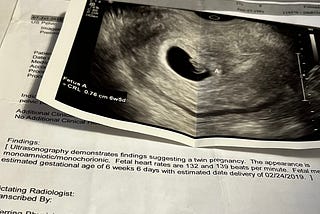 a close up of an ultrasound entitled “fetus A” lays on a white sheet of paper. The text explains the finding of an ultrasound, twins.