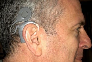 THE PARADOX OF TEMPORARY PERMANENCE: MY COCHLEAR IMPLANT JOURNEY