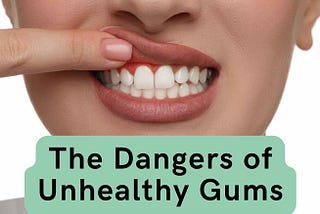 The Dangers of Unhealthy Gums: What You Need to Know