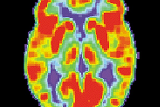 PET scan of a normal brain