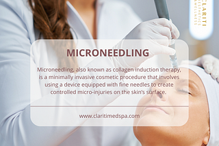 Microneedling in Houston, TX: Rejuvenate Your Skin at Clariti Medspa