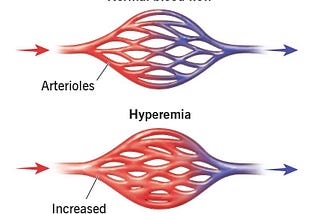 Arterial hyperemia, also known as active hyperemia, refers to an increased blood flow to a…