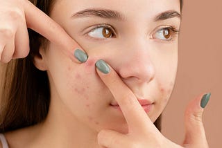 Clear Skin Secrets: A Comprehensive Guide to Tackling Acne from the Inside Out