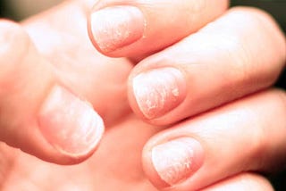 How To Strengthen Weak and Brittle Nails