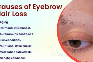 Get Effective Eyebrow Hair Loss Treatment with Personalized Homeopathic Medicines