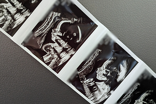 Author’s ultrasound photos
