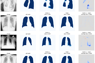 The best approach to semantic segmentation of biomedical images