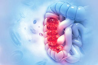 How to Test & Diagnose Colorectal (Rectal or Colon) Cancer