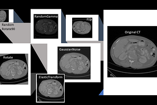 3D Data-Augmentation Using tf.data and Volumentations-3D Library