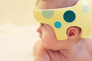 Why are some newborns more prone to developing flat head syndrome?