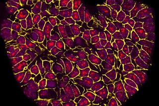 Stunning image of heart-shaped cancer cells wins science photography prize