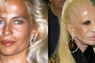 Donatella Versace: Natural Aging vs. Potential Cosmetic Enhancements