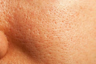 8 ways to minimize large pores