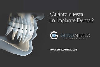 ¿Cuánto cuesta un implante dental?